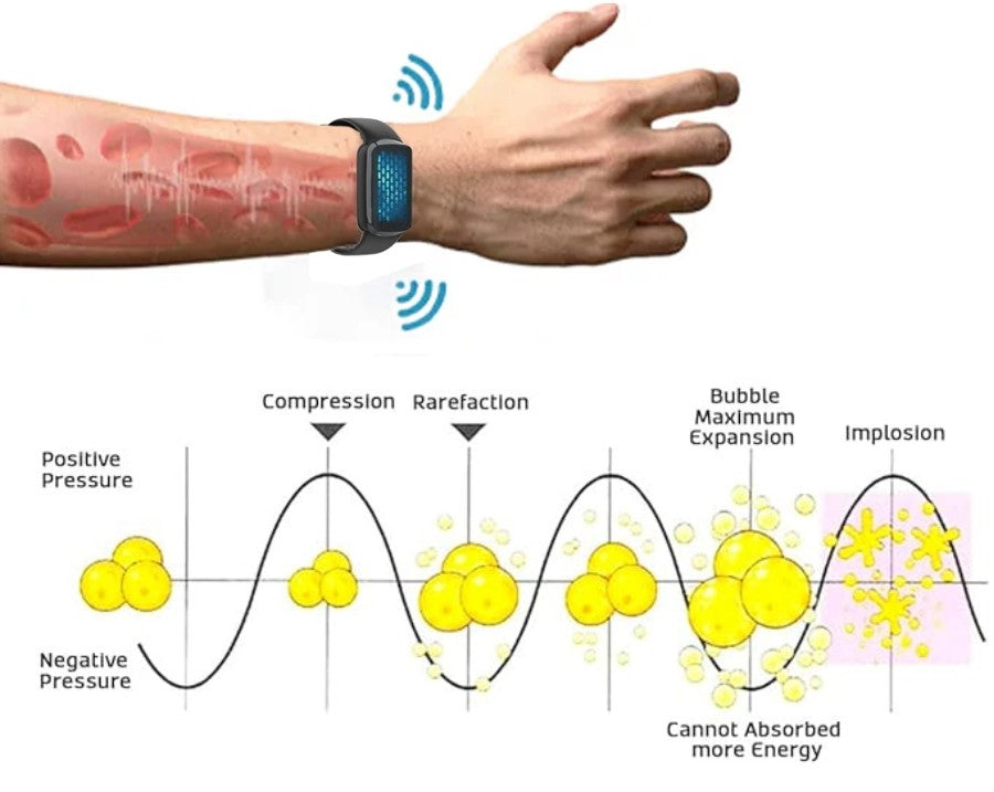 Fivfivgo™ Ultrasonic Fat Burning and Detoxification Bracelet