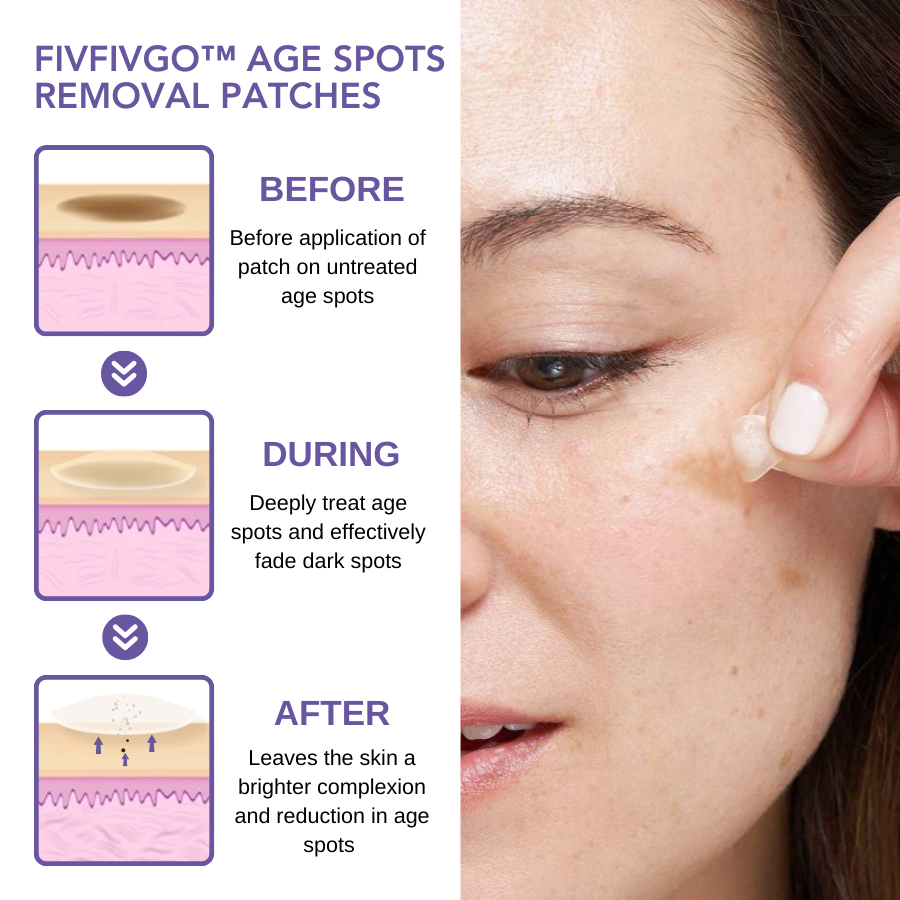 Fivfivgo™ Age Spots Removal Patches