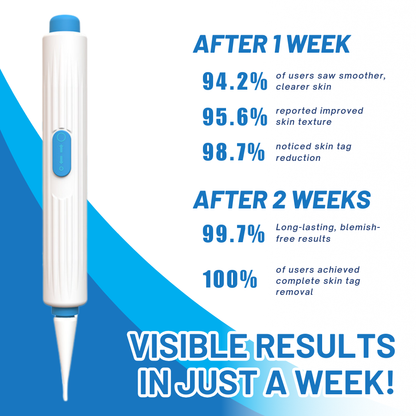 Fivfivgo™ At-home Skin Tag Threading Pen