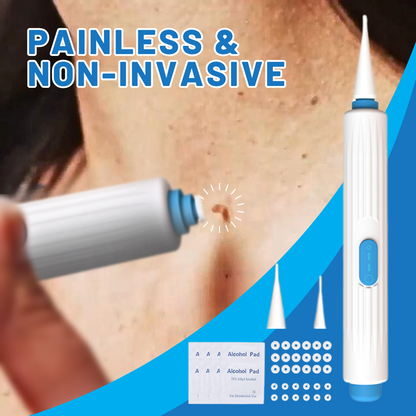 Fivfivgo™ At-home Skin Tag Threading Pen