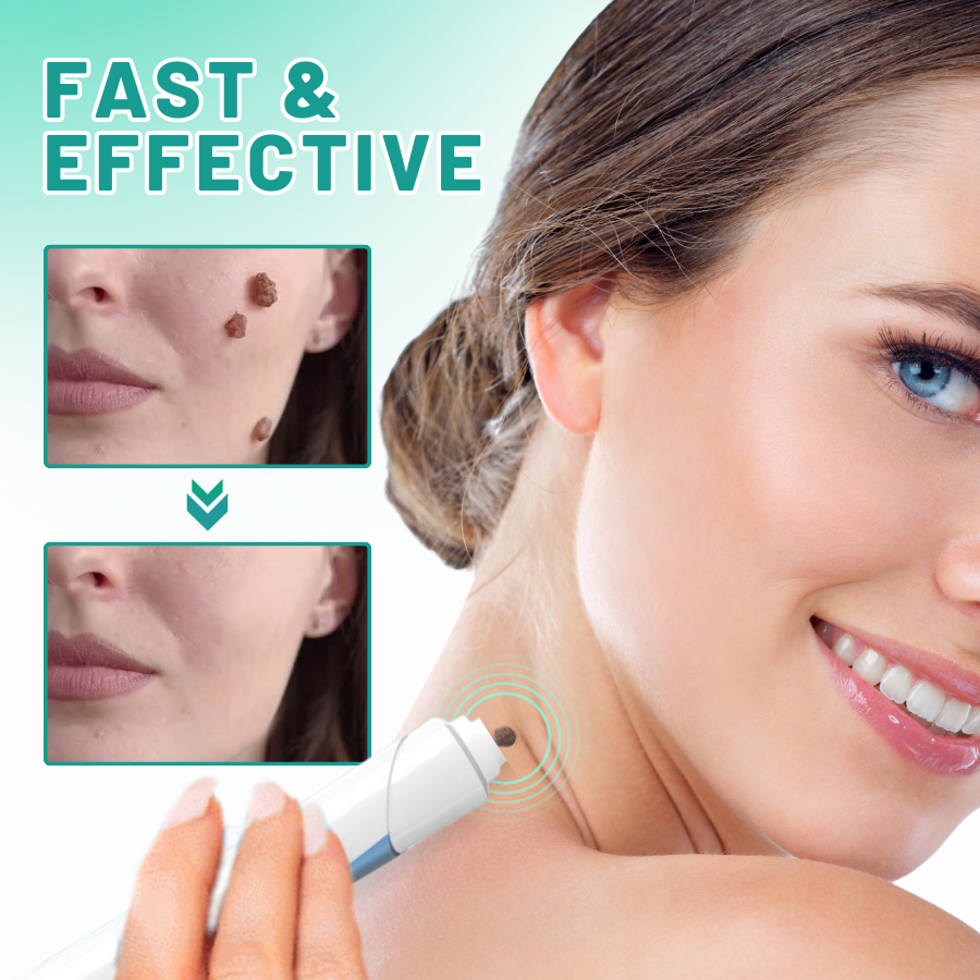 Fivfivgo™ 2-in1 Skin Tag Removal Kit