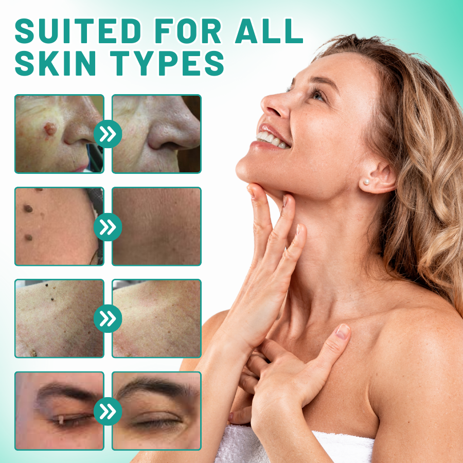 Fivfivgo™ 2-in1 Skin Tag Removal Kit