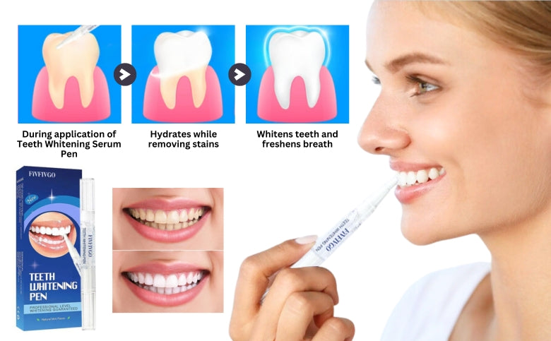 Fivfivgo™ Medical-Grade Teeth Whitening Serum Pen