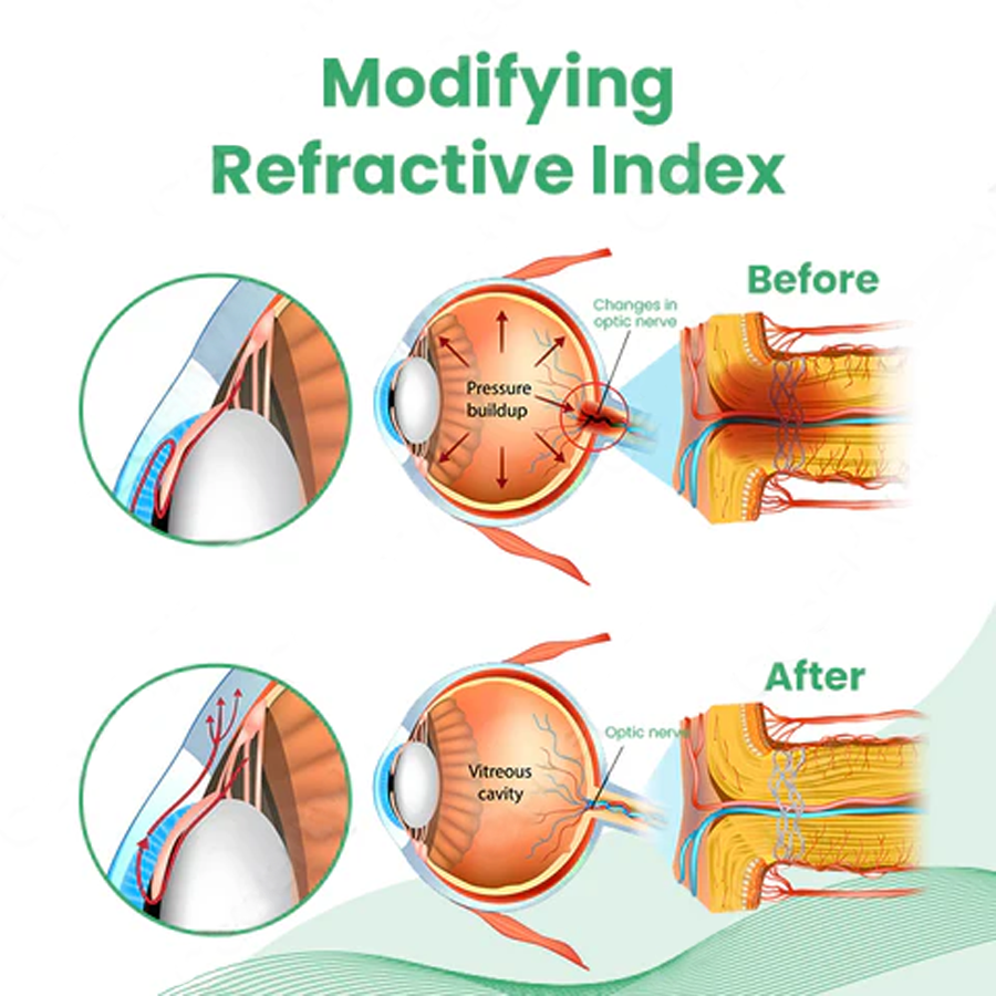 Fivfivgo™ EYEase Myopia Cure Drops