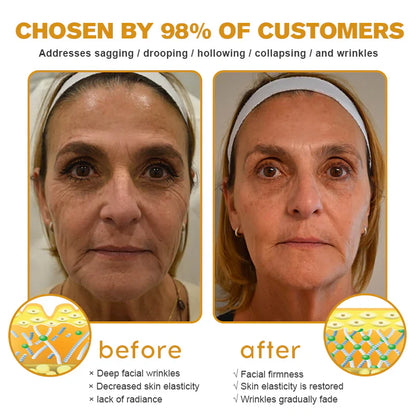 Fivfivgo™ Wrinkle Removal Cream (with Water-based Beeswax and Botox Effect)