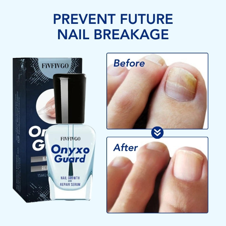 Fivfivgo™ OnyxoGuard Sérum de croissance et de réparation des ongles 